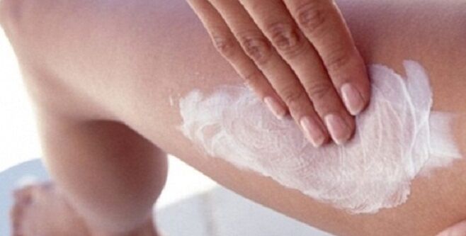 Application of medicated ointment on the legs for varicose veins
